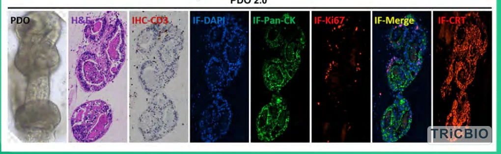 Bright-field, histology, epithelial, proliferation and immune-marker profiling in a PDO 2.0 model
