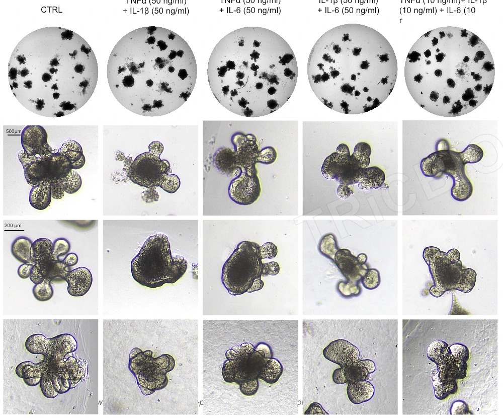 Mouse intestinal organoid morphology under inflammatory treatment conditions