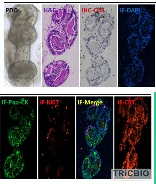 Histology, epithelial and immune-component readouts in a PDO 2.0 model