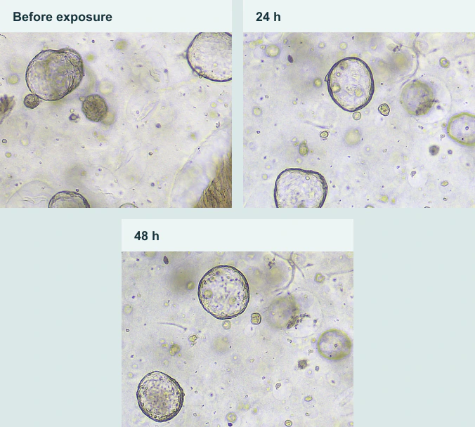Human kidney organoid morphology before and 24/48 hours after doxorubicin exposure