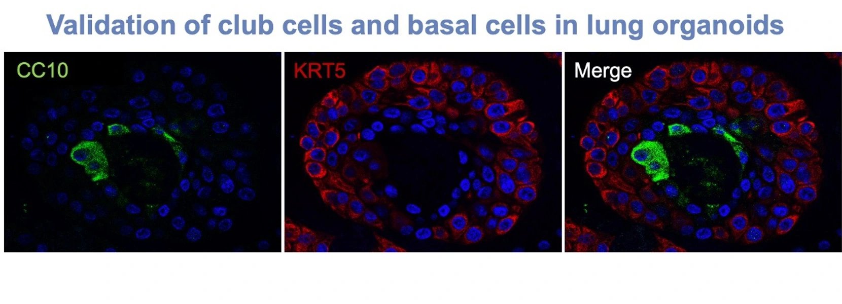 SCGB1A1 (CC10), KRT5 and merged airway-cell marker readouts in normal lung organoids