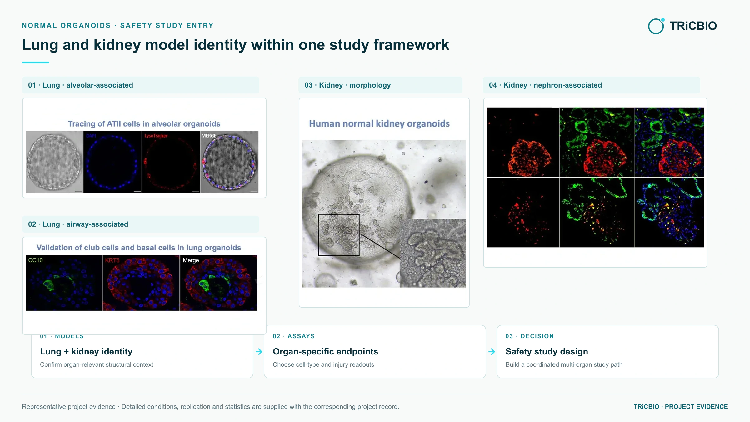 Model characterization and injury-related readouts in normal lung and kidney organoids