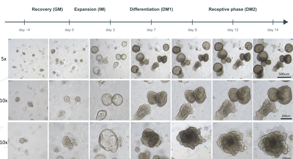 Serial morphology of endometrial organoids across culture stages