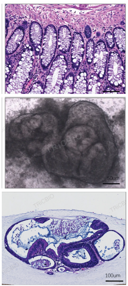 Colorectal source-tissue and PDO morphology figure set