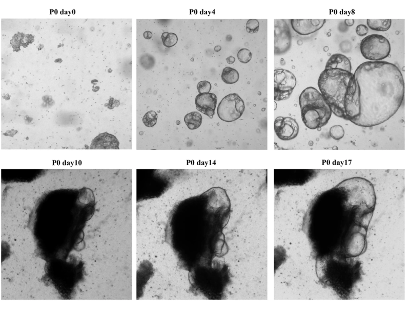 Serial culture of adjacent non-tumor liver organoids from early P0 to later growth stages