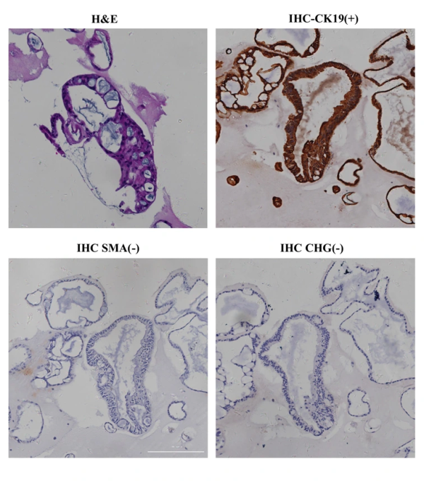 H&E and CK19/SMA immunohistochemistry in adjacent non-tumor liver organoids