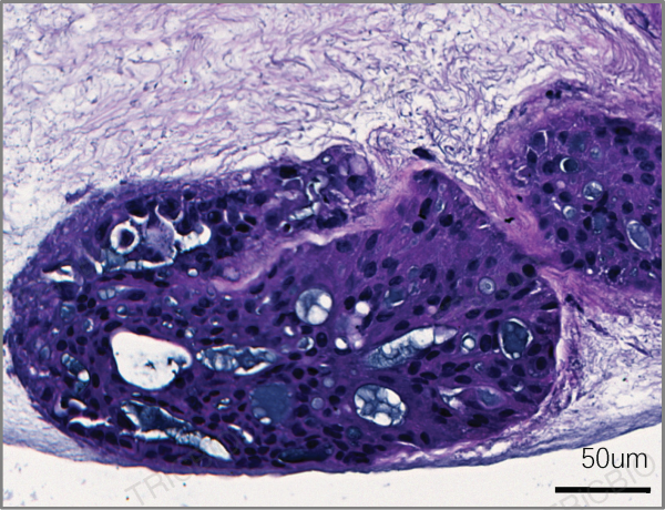 Tissue structure in the PDO section
