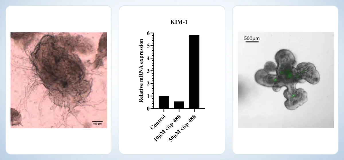 Organoid morphology, KIM-1 molecular assay and barrier-permeability functional assay