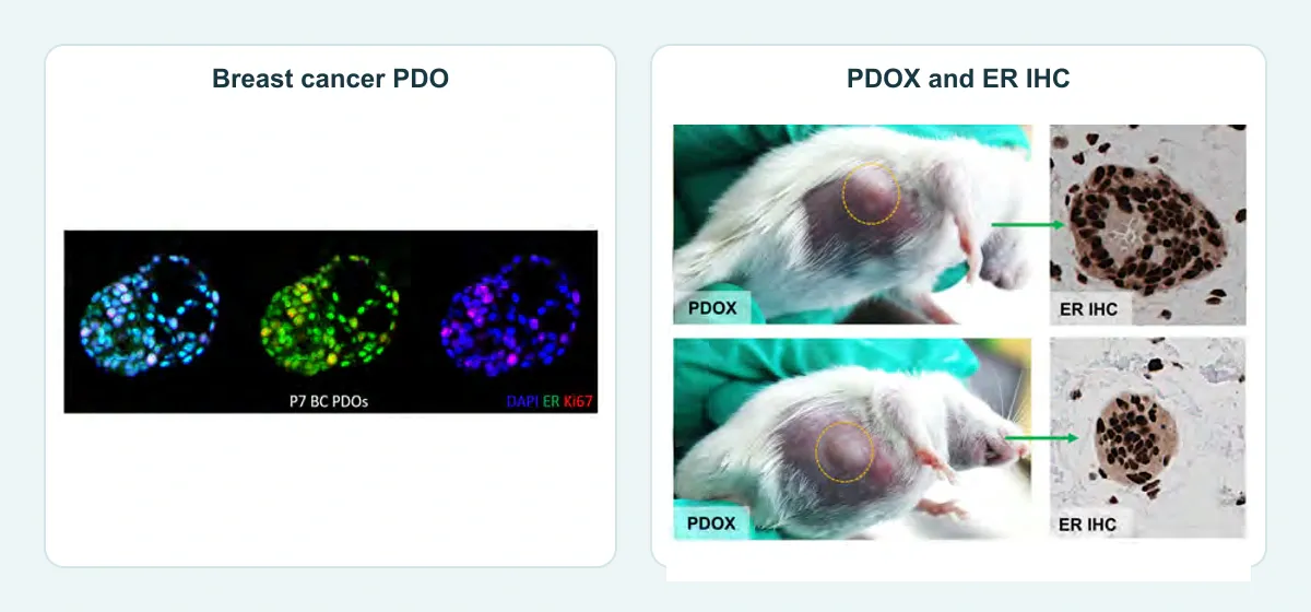 ER and Ki67 phenotypes in a breast cancer PDO alongside ER immunohistochemistry in PDOX tissue