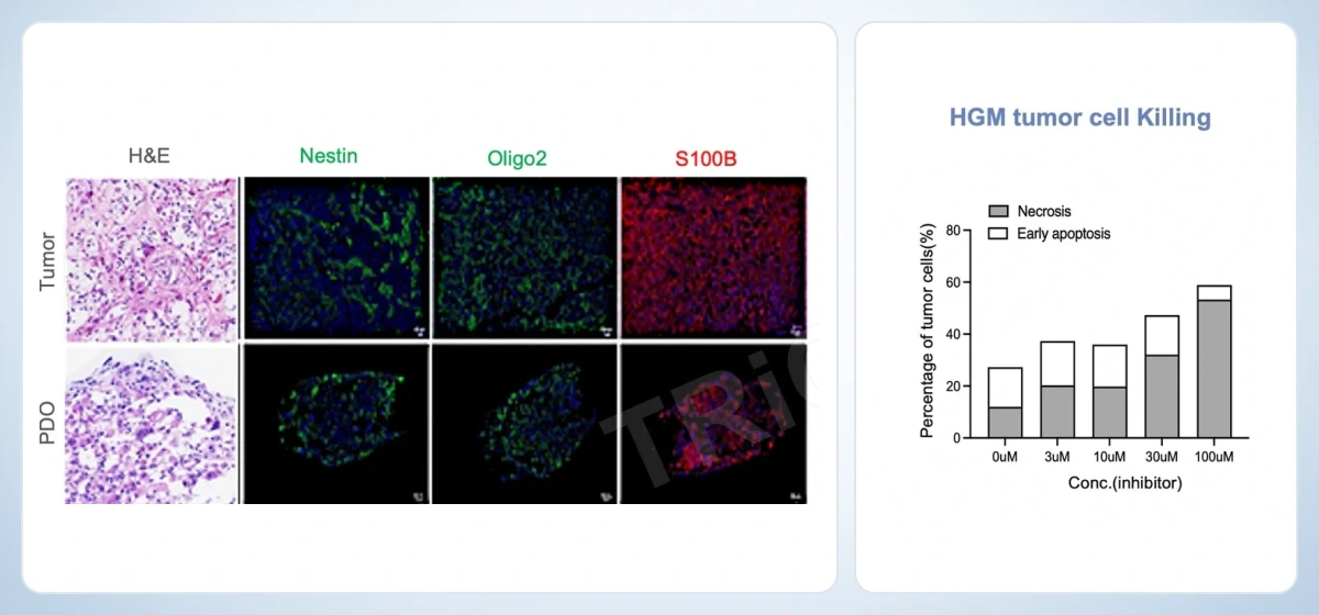 GBM PDO lineage profiling and HGM tumor-cell killing readouts from complementary glioma studies