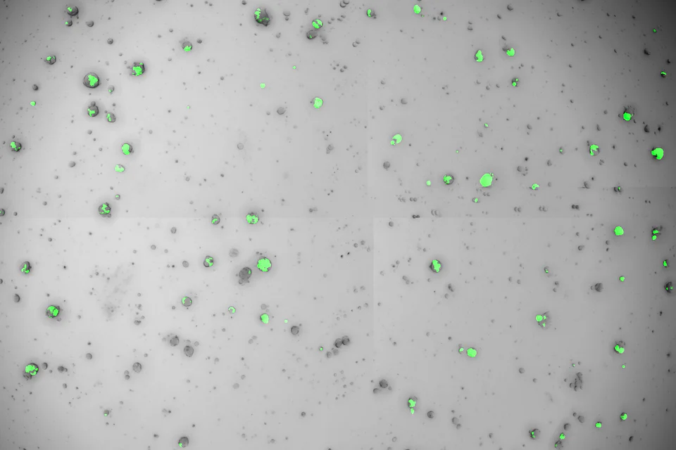 肝癌类器官 · lncRNA shRNA条件 · 第3天